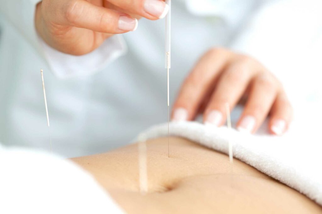 Acupuncture contre la candiodose vaginale à Paris