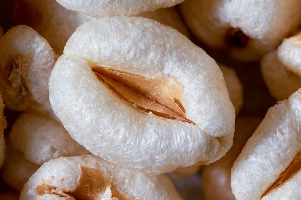 Candidose vaginale et acupuncture (2) - Dr Nguyen