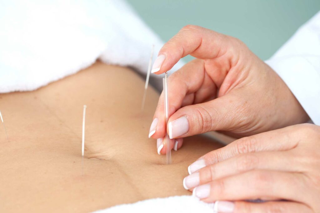 Candidose vaginale et acupuncture (4) - Dr Nguyen
