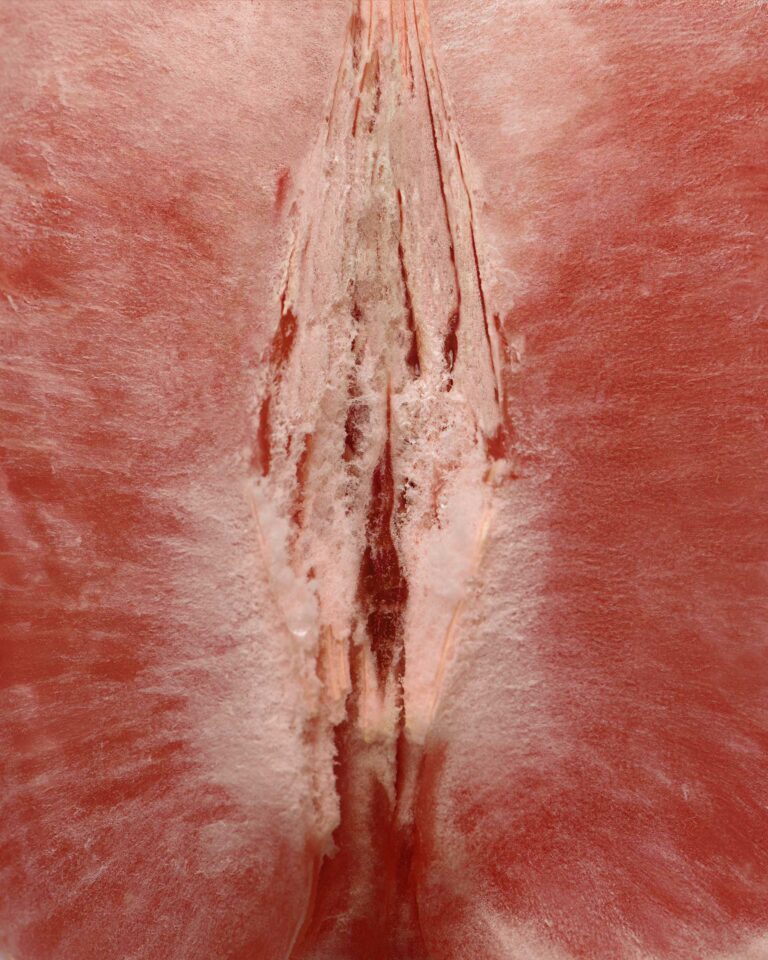 Vaginisme et acupuncture - Dr NGUYEN à Paris