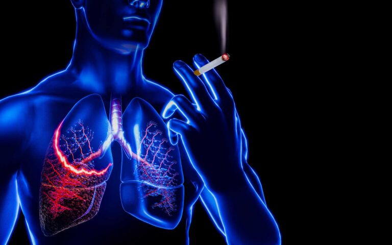 L’Acupuncture Face à la Fibrose Pulmonaire