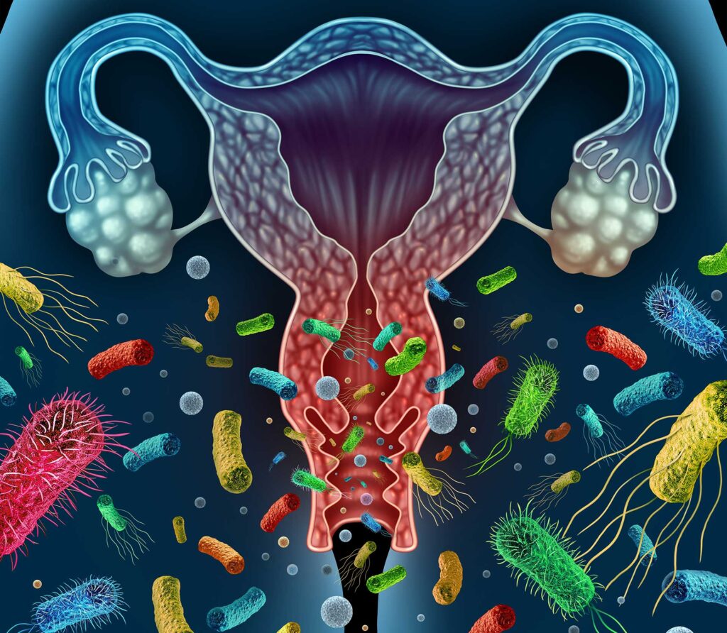 L’acupuncture : une aide précieuse contre urétrite et cervicite