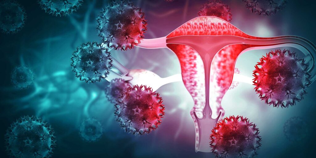 L’acupuncture dans les condylomes acuminés