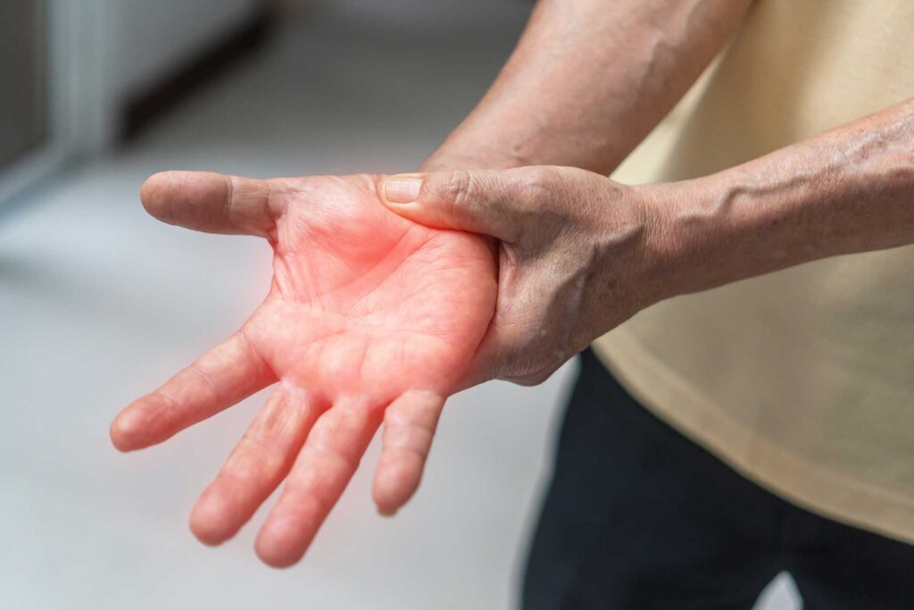 Acupuncture et neuropathie post-chimiothérapie