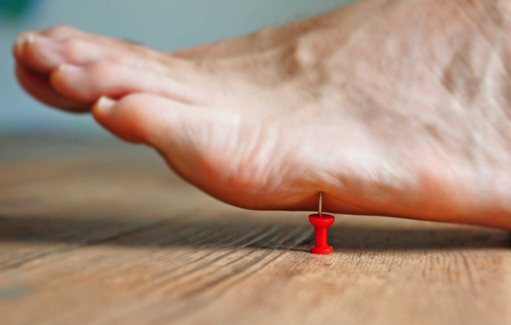 Acupuncture et neuropathie post-chimiothérapie : faire circuler le Qi jusqu’aux extrémités