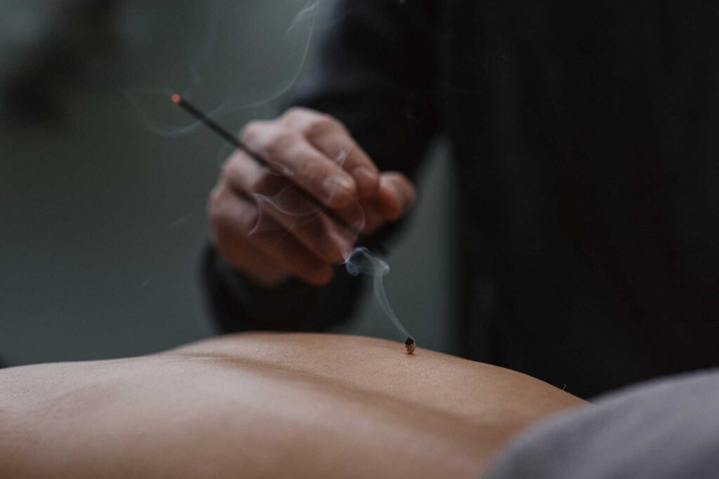 L'acupuncture, Combien ça coûte ? - Dr Nguyen à Paris