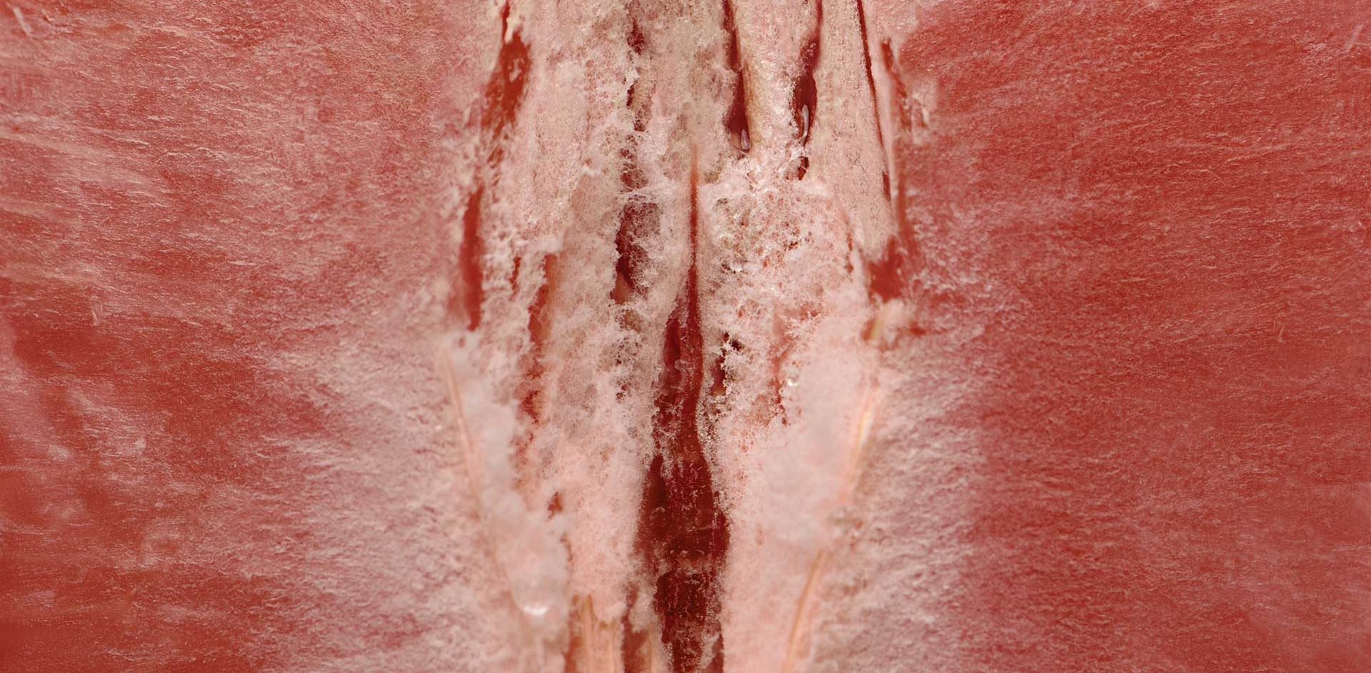 Vaginisme et acupuncture - Dr NGUYEN à Paris